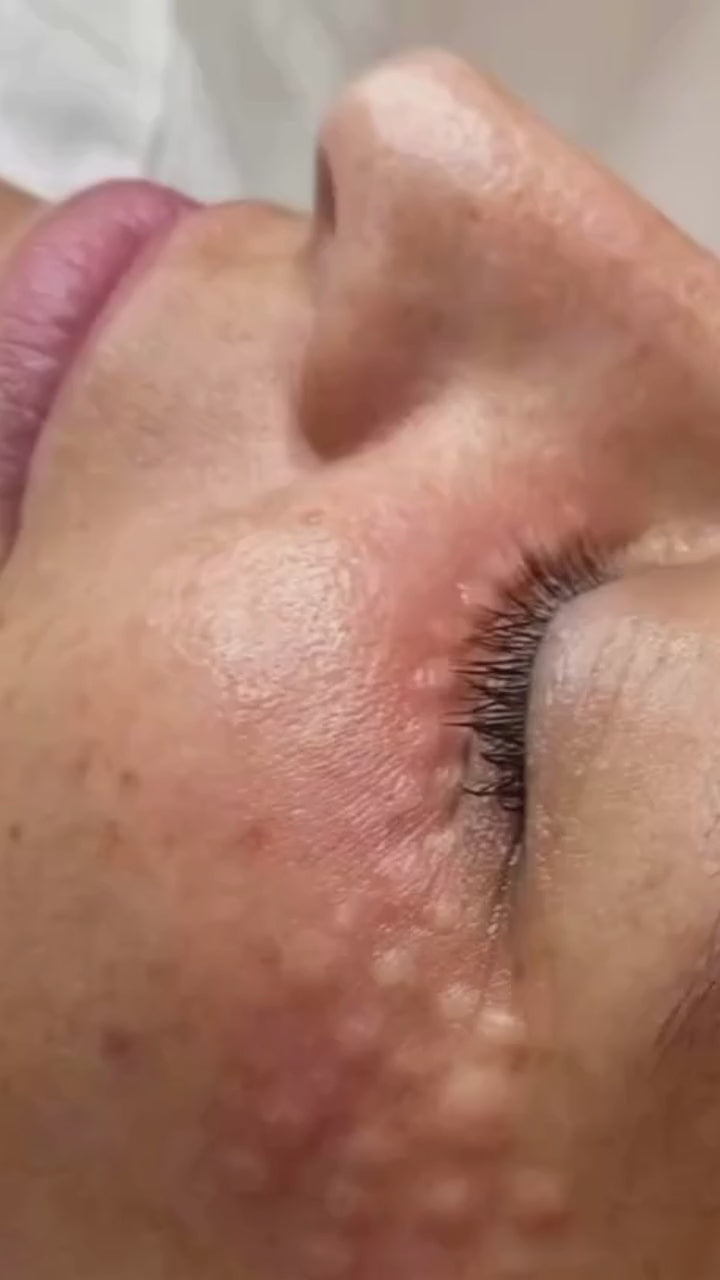 Load video: MicronJet™ 600 / 0.6mm (Box of 30)